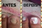 Foto 31